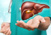 hemolytic uremic syndrome treatments